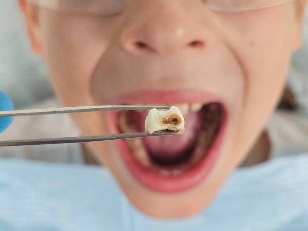 Best Emergency Dental Care for Trauma or Injury in Haskell, OK